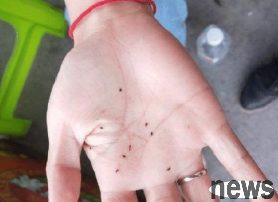 After playing with my dog ​​for a few minutes, black spots appeared on my legs. I was very confused: What are these?